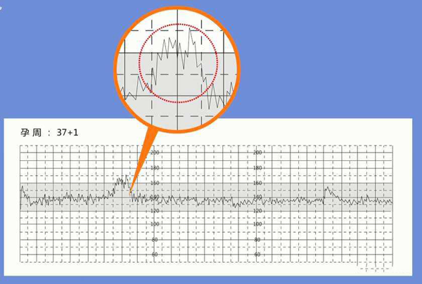 看胎心率